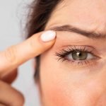 Upper eyelid surgery by Kliniek het Bolwerk