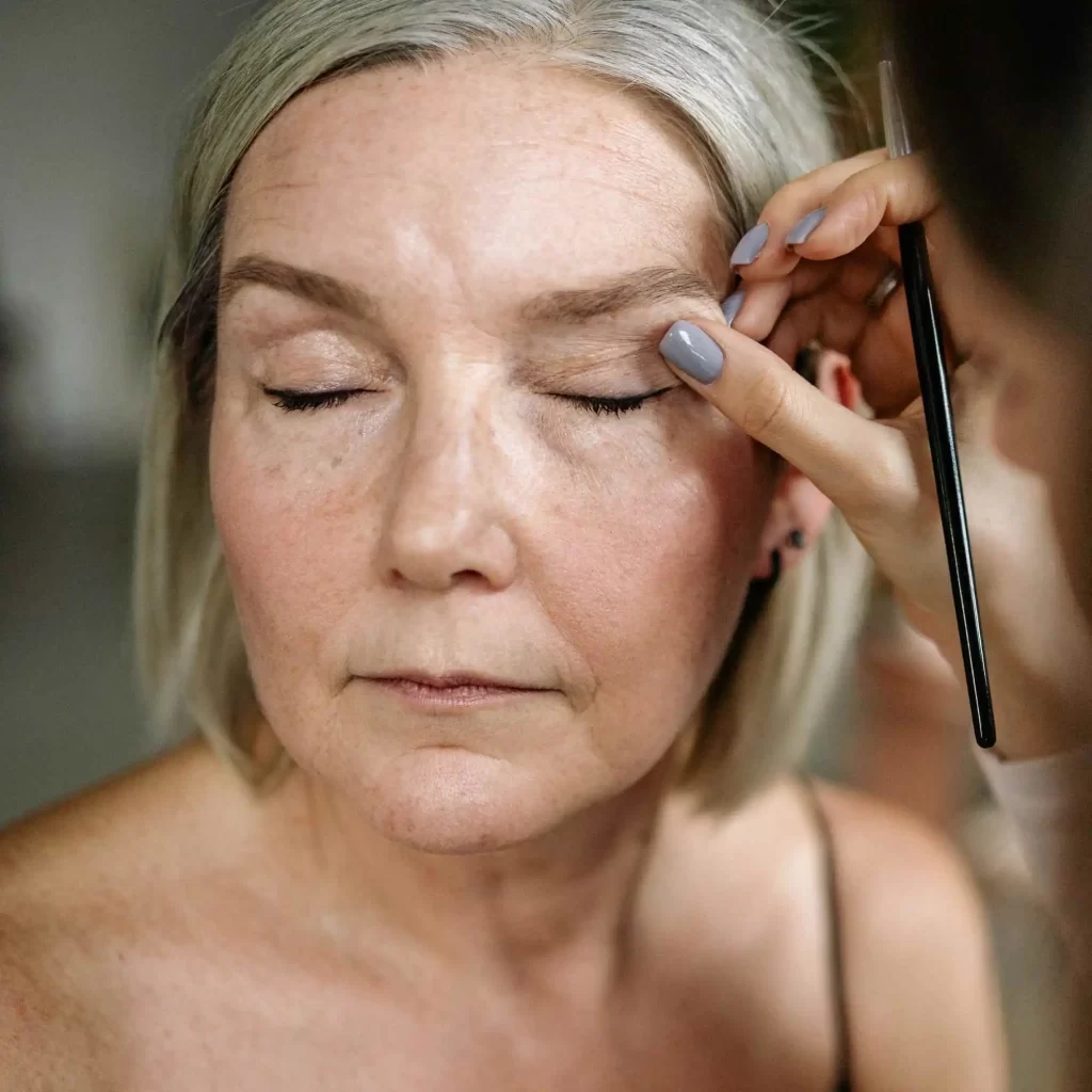 Eyelid surgery by Kliniek het Bolwerk