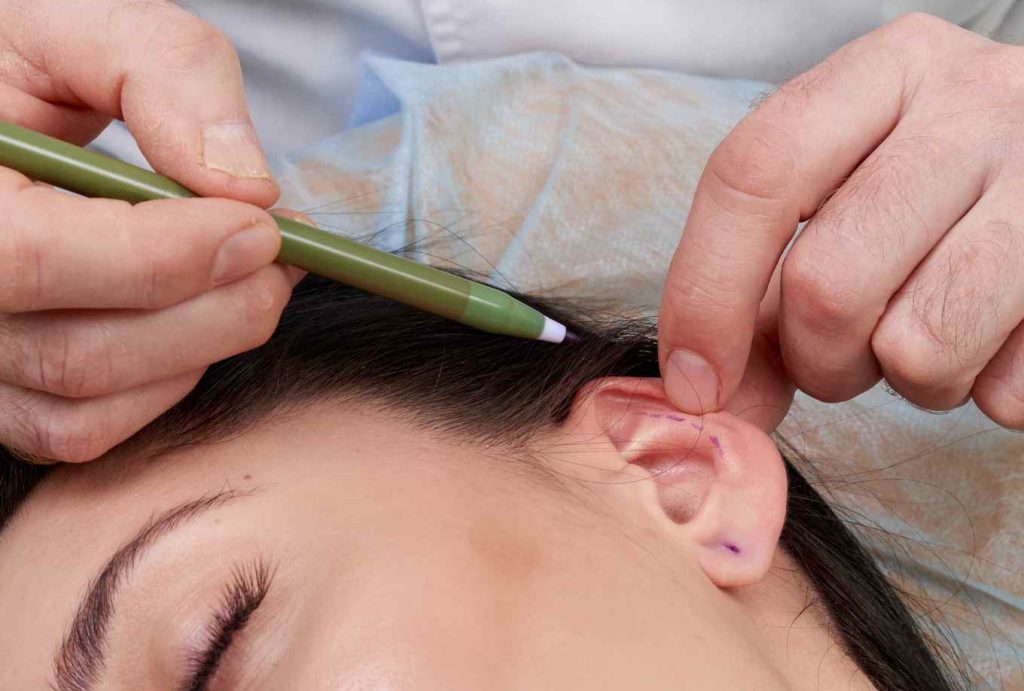 Who is ear correction for