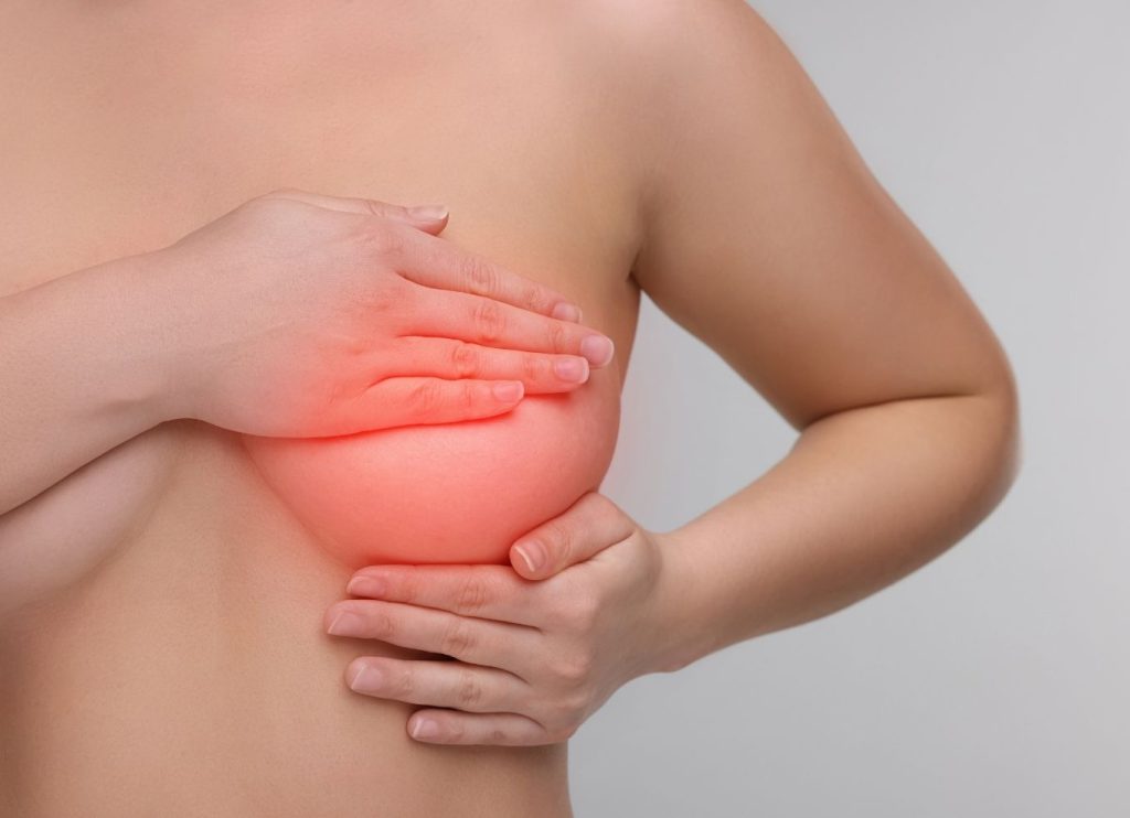 Areola reduction at Kliniek het Bolwerk