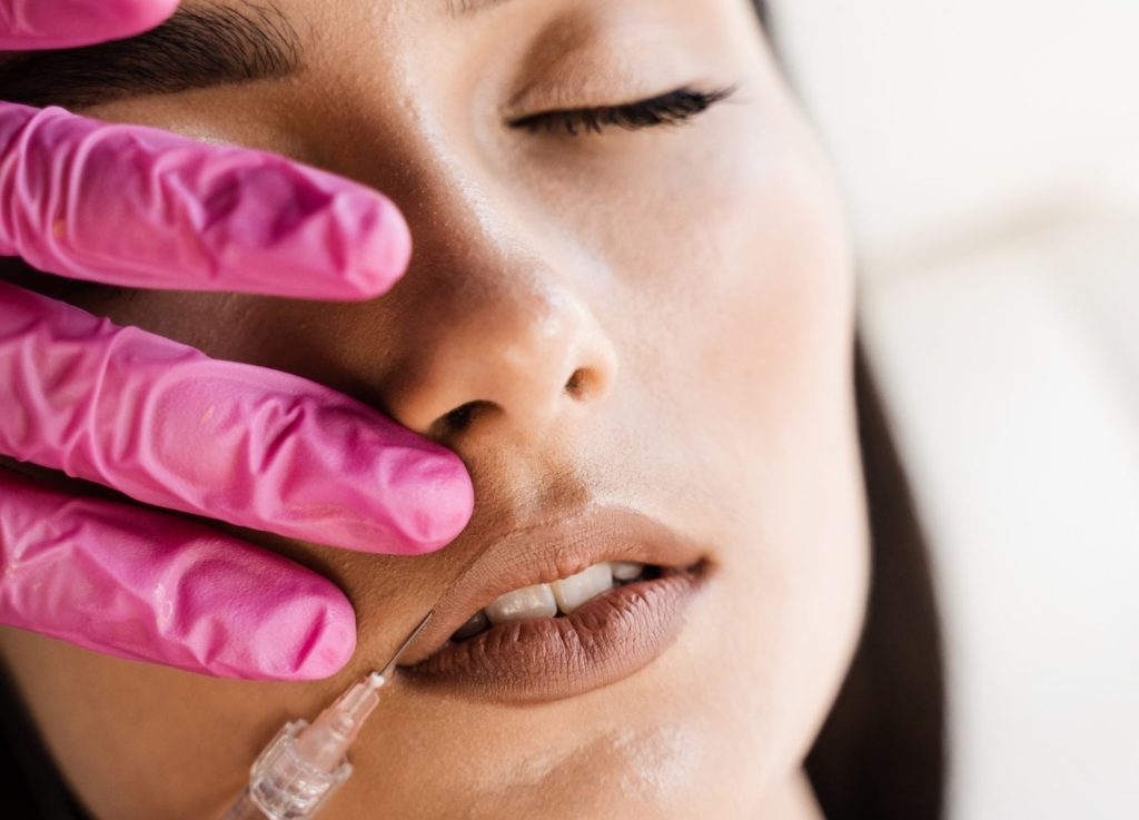 Lipfillerbehandeling bij Kliniek het Bolwerk