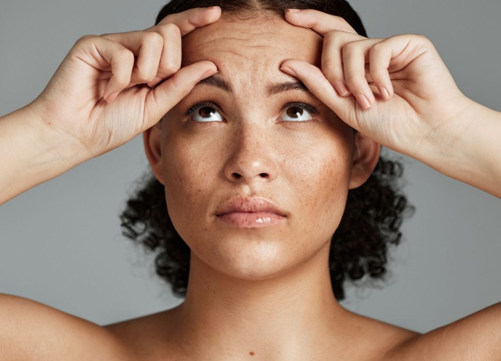 Forehead lines