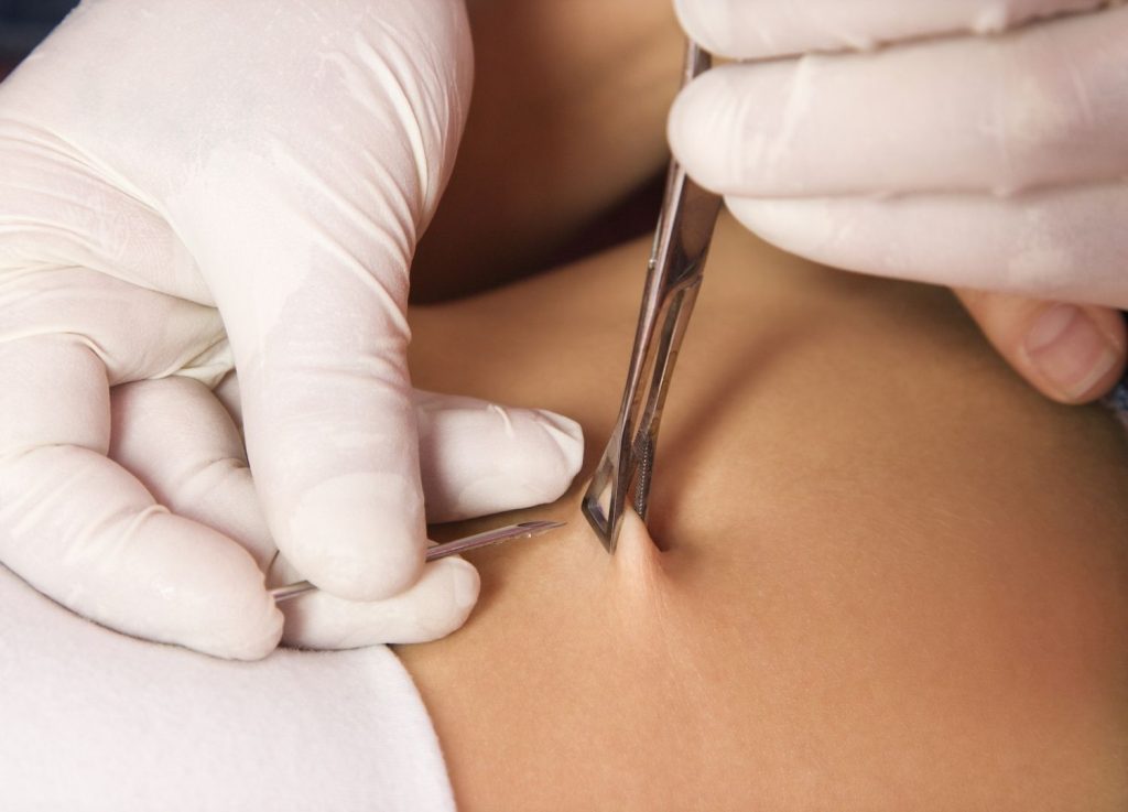 Uitgescheurde piercing