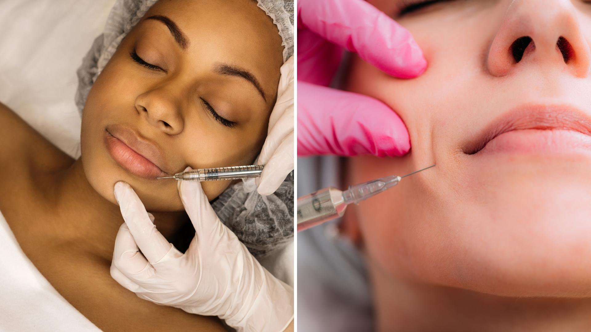 Recovery after fillers